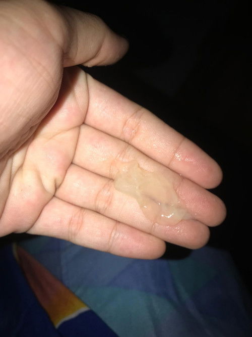 Mucus plug atau bukan ya?