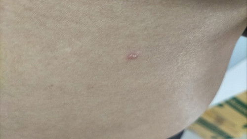 ตั้งครรภ์27W