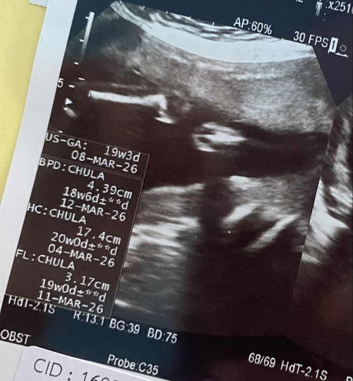 ผู้ชายรึผู้หญิงคะแม่ๆ