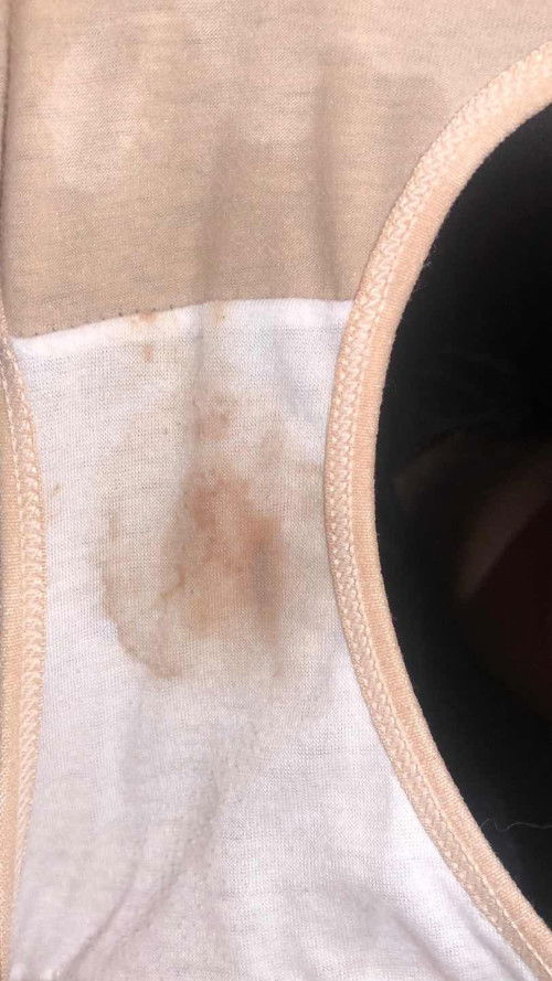 Tak pasti ni keputihan warna coklat atau darah