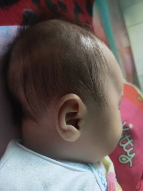 Hair lotion yg ampuh