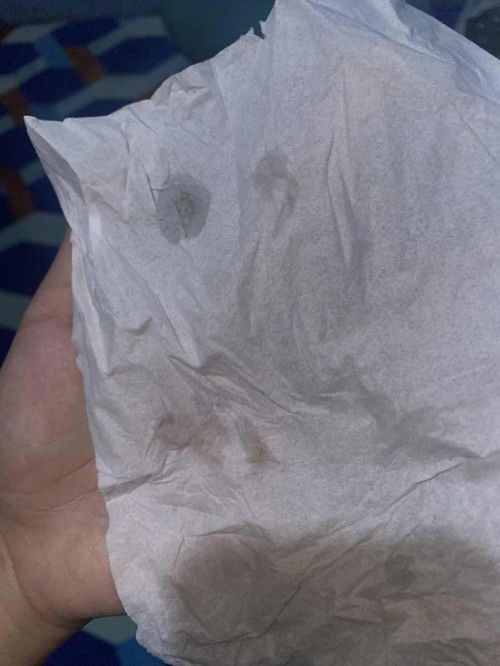 Keluar flek di usia 4 week