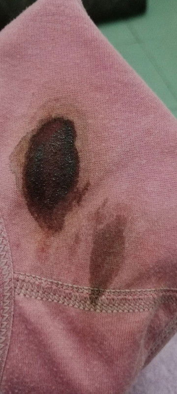 Assalamu'alaikum bunda,,,  maaf jika share foto yg menjijikkan 🙏 usia kandungan 27 minggu