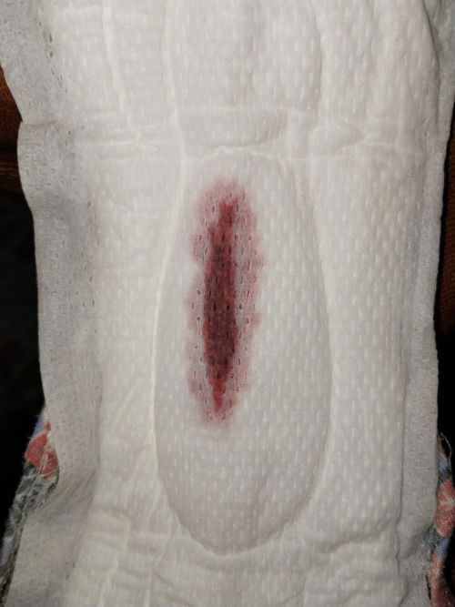 nakakaranas rin po ako ng mga sintomas and nakailang try rin po kami mag conceive