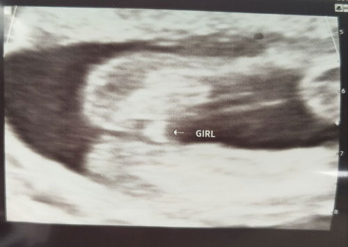 Confirm ya baby girls?