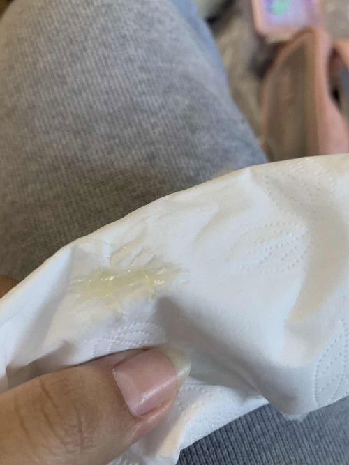 39+2มีมูกใสแล้วก็น้ำไหลออกมาทีละนิด