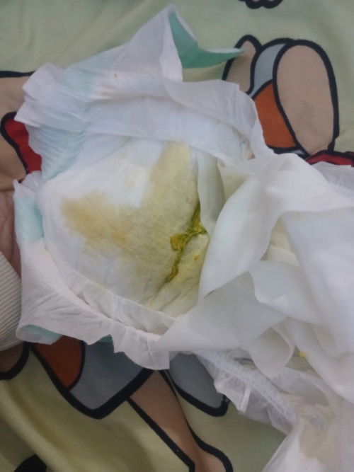 1เดือนกินนมแม่ถ่ายแบบนี้ปกคิไหมคะ🥹