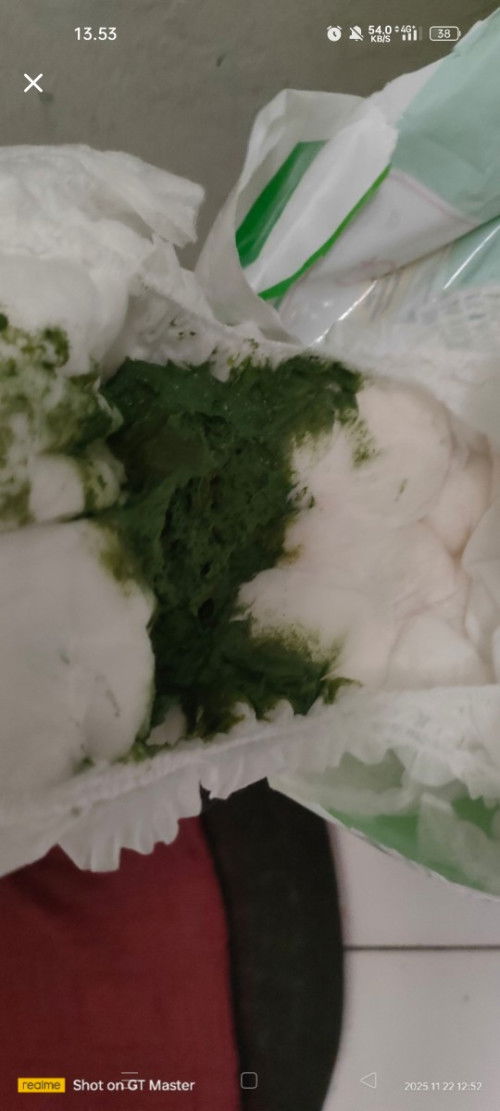 Bun, balita poop nya 2 hari berwarna hijau btw anak aku dari dulu susunya soya, ada yang pernahkah?