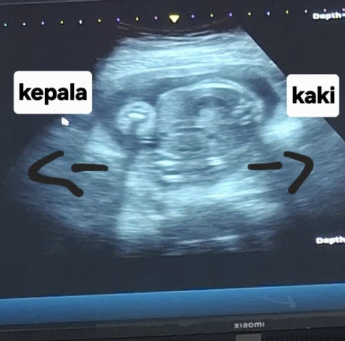 Jenis kelamin perempuan atau laki laki