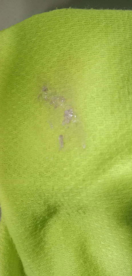 Mga mhie ..ano Po kaya ito ?.Nakita ko Po matapos Ako umihi.
5weeks and 6 days preggy.