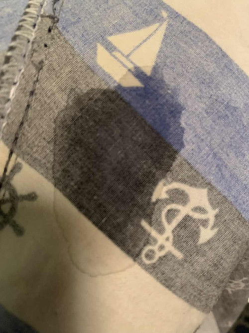 แบบนี้คือตกขาวใหลเยอะ หรือเป็นน้ำอะไรคะ ตื่นนอนมารู้สึกเปลียก🥹