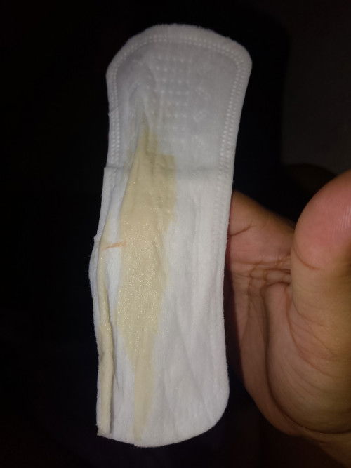 mga mi normal ba to 38 weeks Ang 5 days ako simula kagabi masakit ung puson at balakang pwro Hindi e