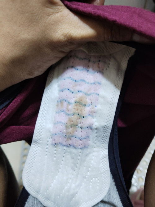 Dapat na ba ko pumunta sa ospital pag ganto discharge