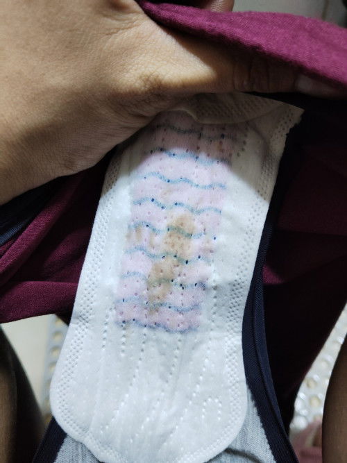 Dapat na ba ko pumunta sa ospital pag ganto discharge