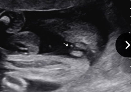 Agak2 boy or girl ya?