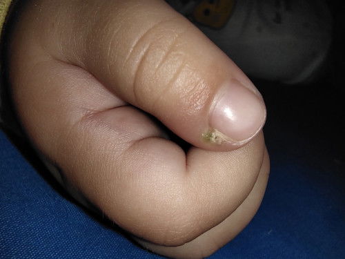 Tolong rekomendasi salep atau perawatan