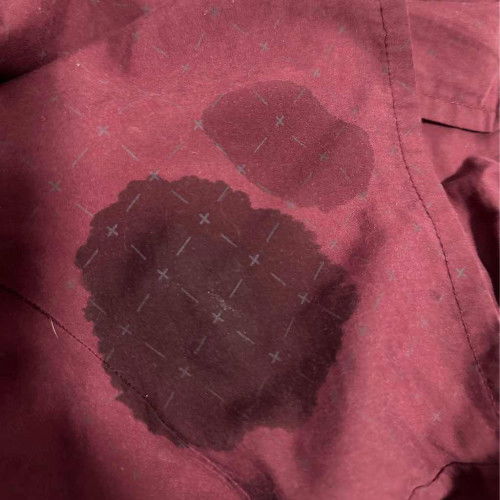 ตั้งครรภ์36สัปดาห์ แบบนี้เรียกตกขาวมามากหรืออะไรค่ะ