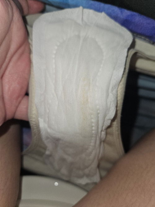 First Trimester Spotting