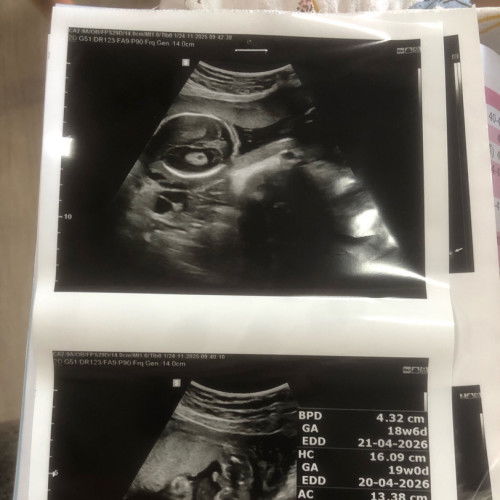 ขอสอบถามหน่อยคะ