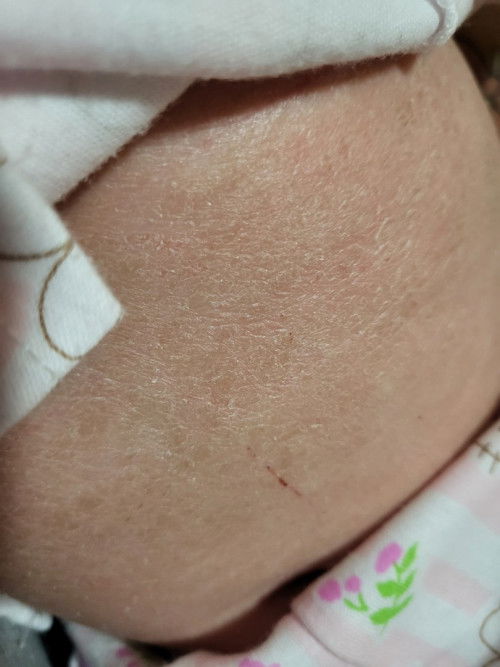 ครีมทาผิว(แห้ง)​