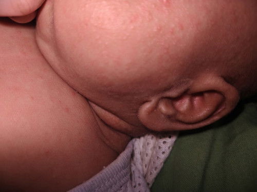 ruam ke? momies2 mohin bantu