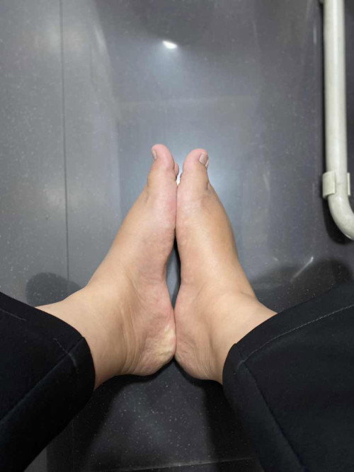 Kaki dan tangan bengkak