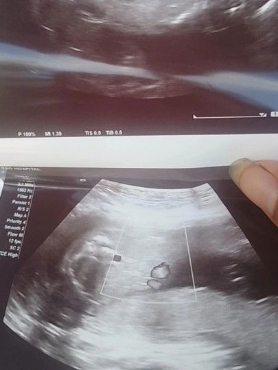 ขอสอบถามค่ะ