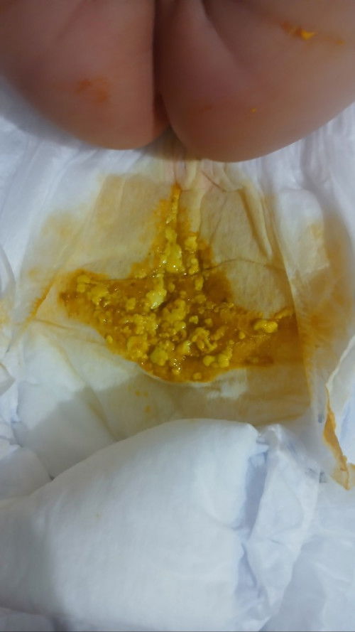 Normal po ba na poop ito?