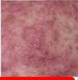 Perih di selangkangan saat hamil