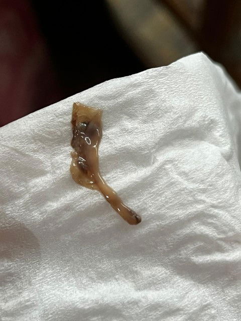 Bun, maaf tanya kalau seperti ini gimana ya? Saya sudah periksa ke dsOG dah dikasih penguat juga.