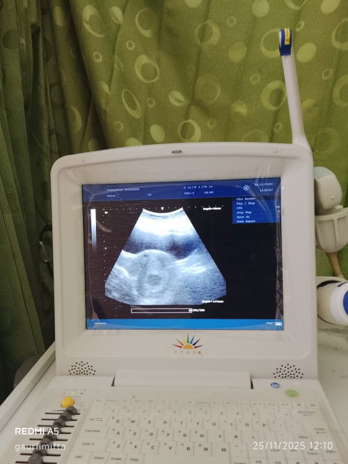 USG 8week haya kantong