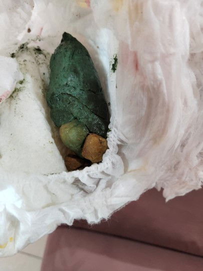 Najis anak setahun 8 bulan warna hijau