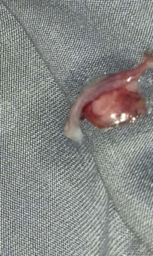 เลือดประจำเดือนหรือเลือดอ่ะไรคะ