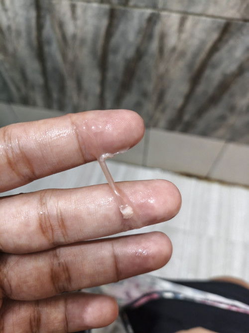 pasin tabi po . meron lumabas na ganyan . yan na ba yung tinatawag na mucus plug?