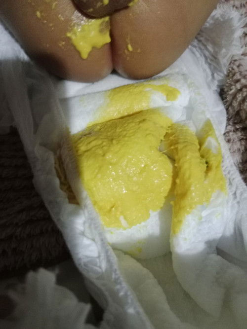 ลูก 3 เดือนอึสีนี้ผิดปกติไหมคะ