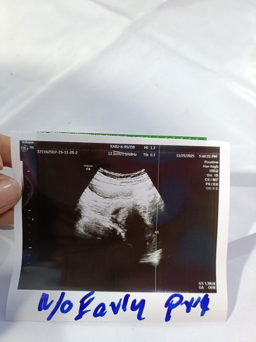 สอบถามแม่ๆที่มีประสบการณ์คะ 1เดือน คือ 5 สัปดาห์ใช่ไหมคะ มีโอกาสท้องลมไหมคะ