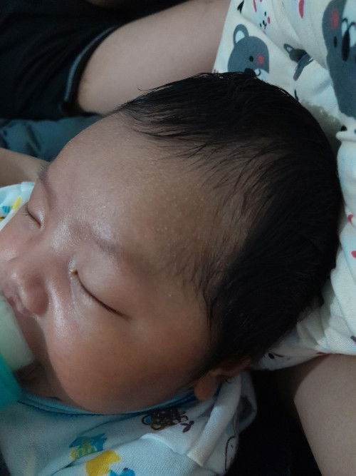 Bintik bintik di dahii