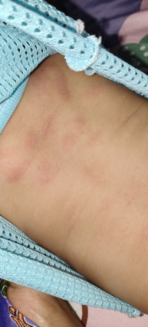 ลูกใครเคยเป็นบ้างคะ