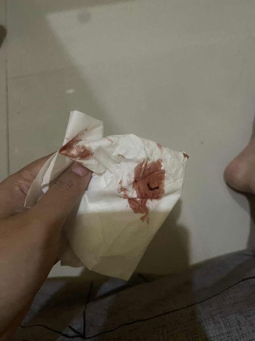 Pengalaman Flek di usia 7minggu