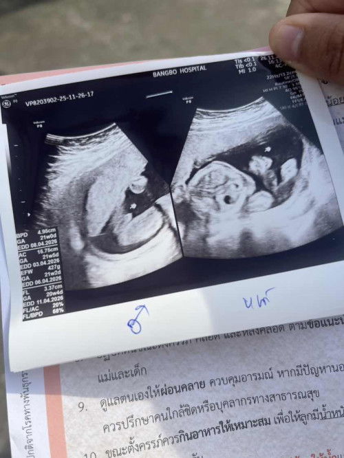 แม่ๆแบบนี้ใช่ลูกชายไหมคะแต่ป้าหมอบอกว่าผู้ชาย