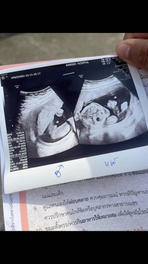 ท้อง2ลูกชายไหมคะแต่ป้าหมอบอกนี้จู้