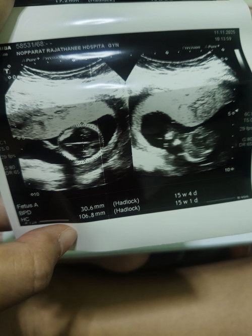 ลูกดิ้นตอนกี่สัปดาห์ค่ะ