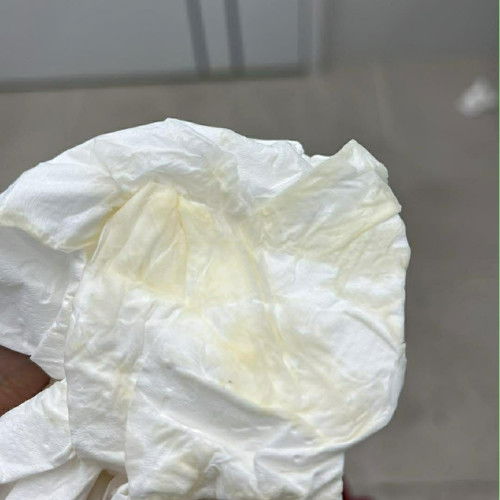 ครรภ์11สัปดาห์4วัน