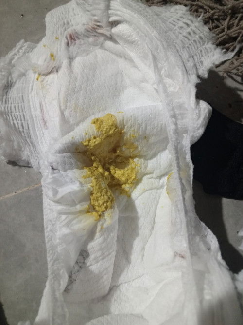 Baby berak kuning pucat lepas tukar susu