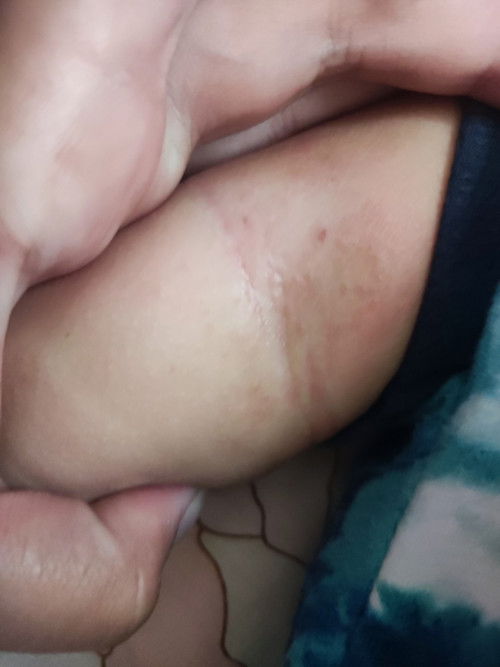 แพ้ออยหรือป่าว