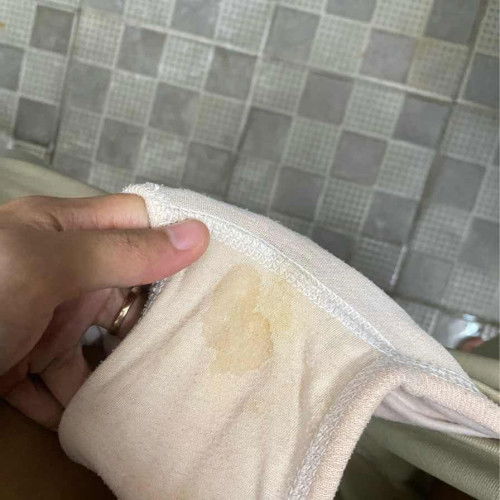 Apakah keputihan bisa cair