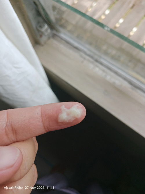 Hamil 9 minggu sering keputihan