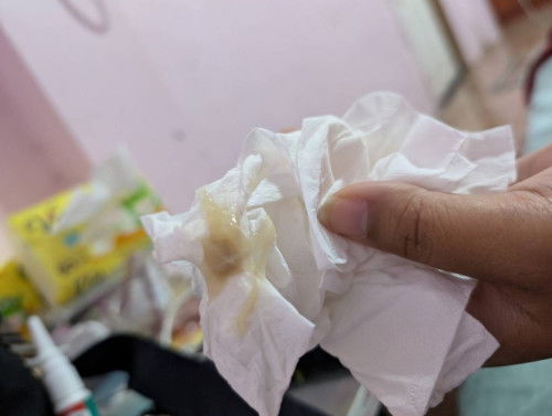 มีมูกออก อายุครรภ์ 23+2