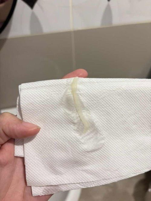 แม่ๆบ้านไหนเป็นแบบนี้บ้างค่ะ