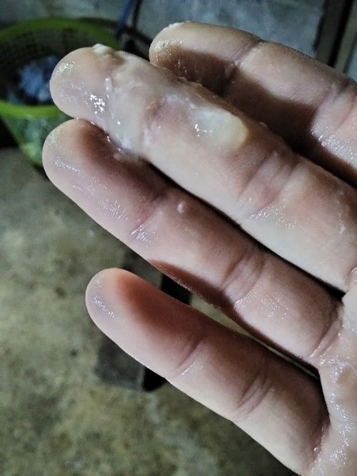 มูกใสๆเเบบนี้คืออะไรคะเเม่ๆ ใช่มูกใกล้คลอดไหม 38+1สัปดาห์   มีเเต่ท้องเเข็งเป็นบางครั้งคะ ควรไปหาหมอ